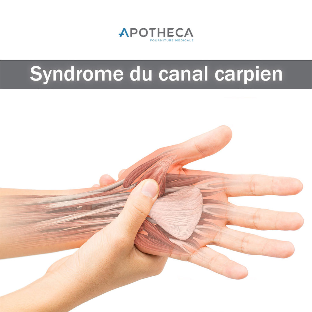 Comprendre et traiter le Syndrome du Tunnel Carpien