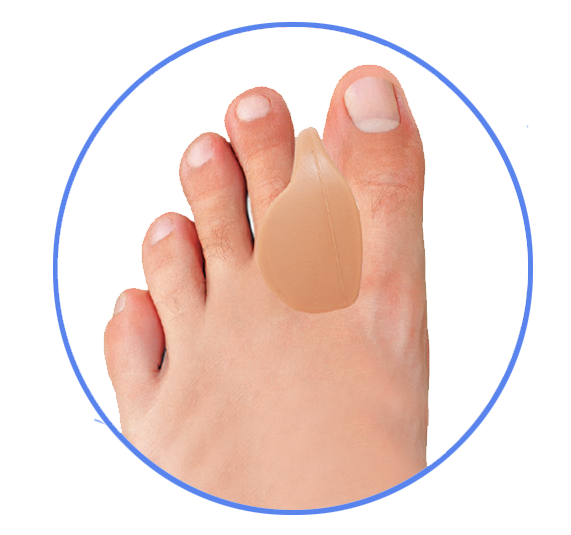 2 Séparateurs D'orteils Silicone Pour Hallux Valgus - Doux, Souple, Taille Unique