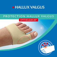 Hallux Valgus